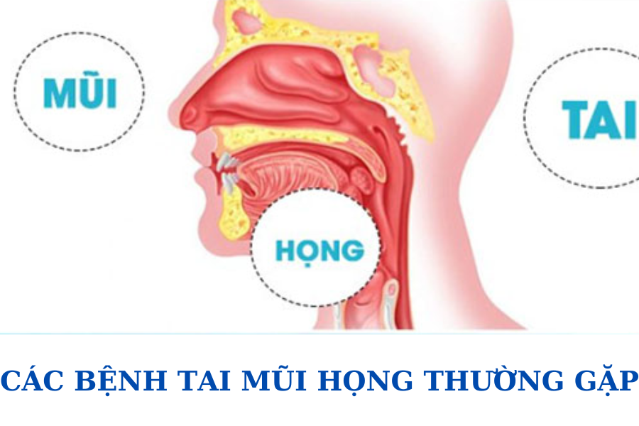 CÁC BỆNH TAI MŨI HỌNG THƯỜNG GẶP Ở TRẺ EM VÀ NGƯỜI LỚN