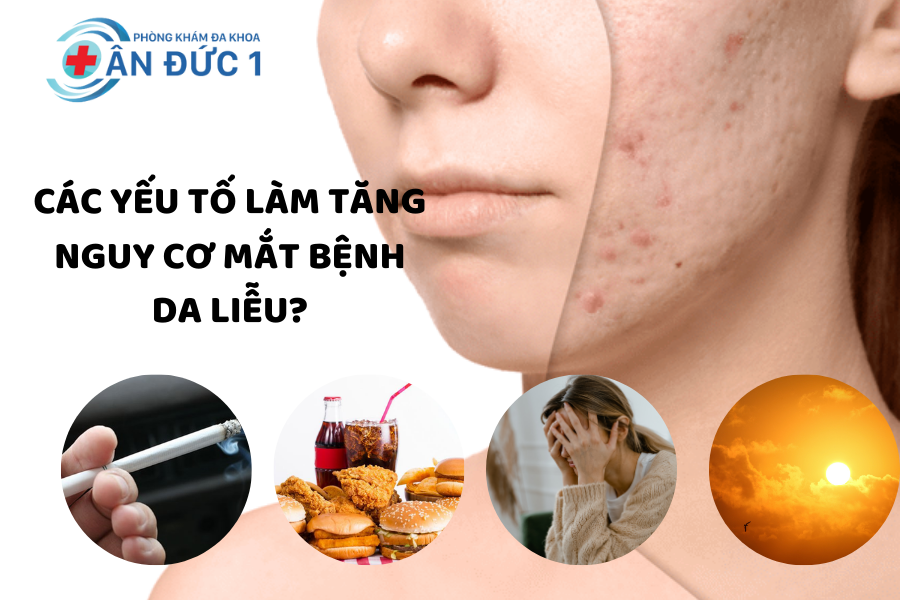 Các yếu tố làm tăng nguy cơ mắc bệnh da liễu