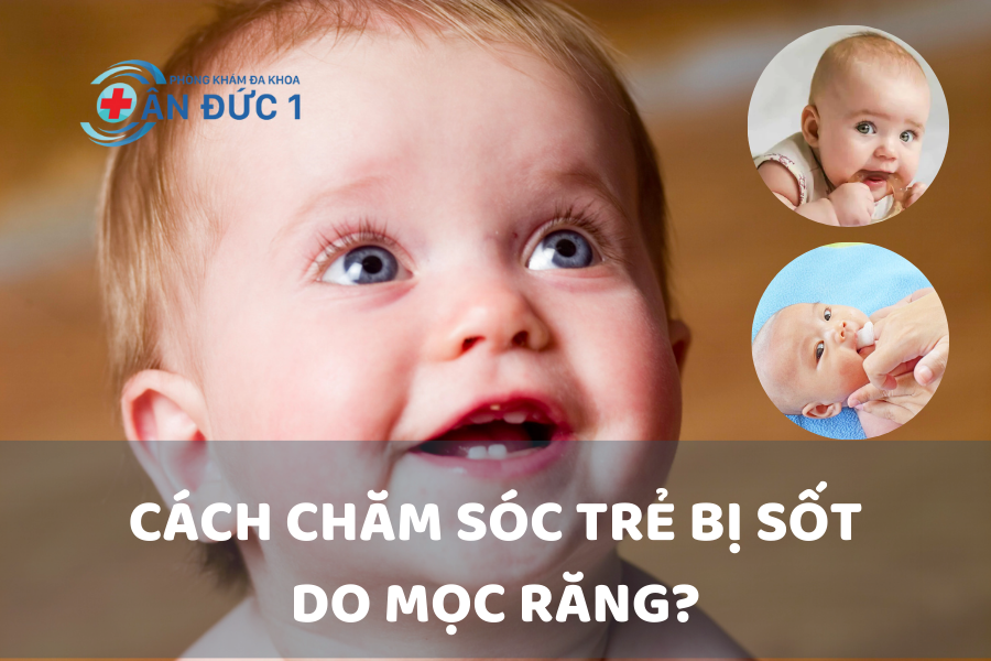 Cách chăm sóc trẻ bị sốt do mọc răng
