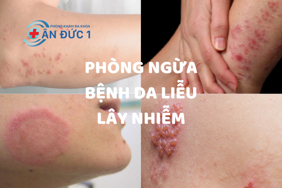 Cách phòng ngừa bệnh da liễu hiệu quả