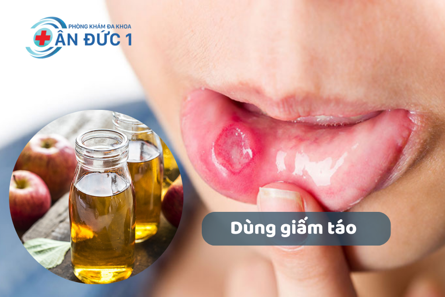 Sử dụng giấm táo