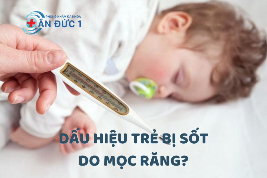 Dấu hiệu trẻ bị sốt do mọc răng