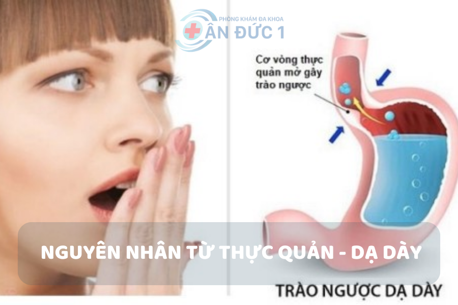 Nguyên nhân từ dạ dày - thực quản