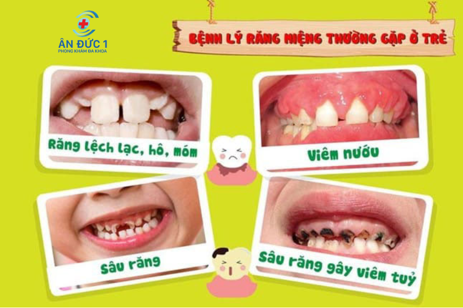 5 BỆNH RĂNG MIỆNG THƯỜNG GẶP Ở TRẺ EM