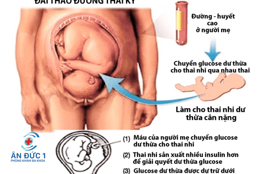 tiểu đường ở thai kỳ