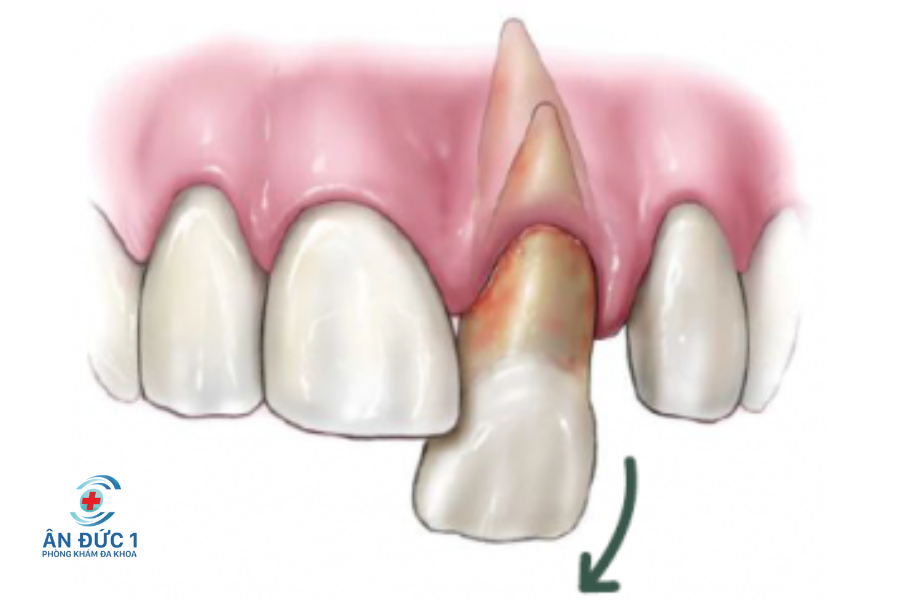 Bệnh răng miệng thường gặp