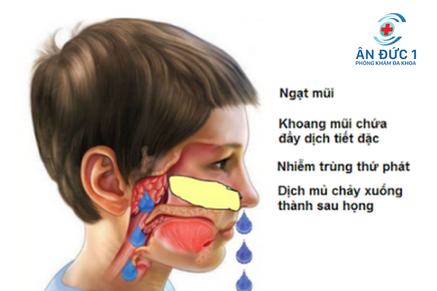 phòng tránh bệnh tai mũi họng