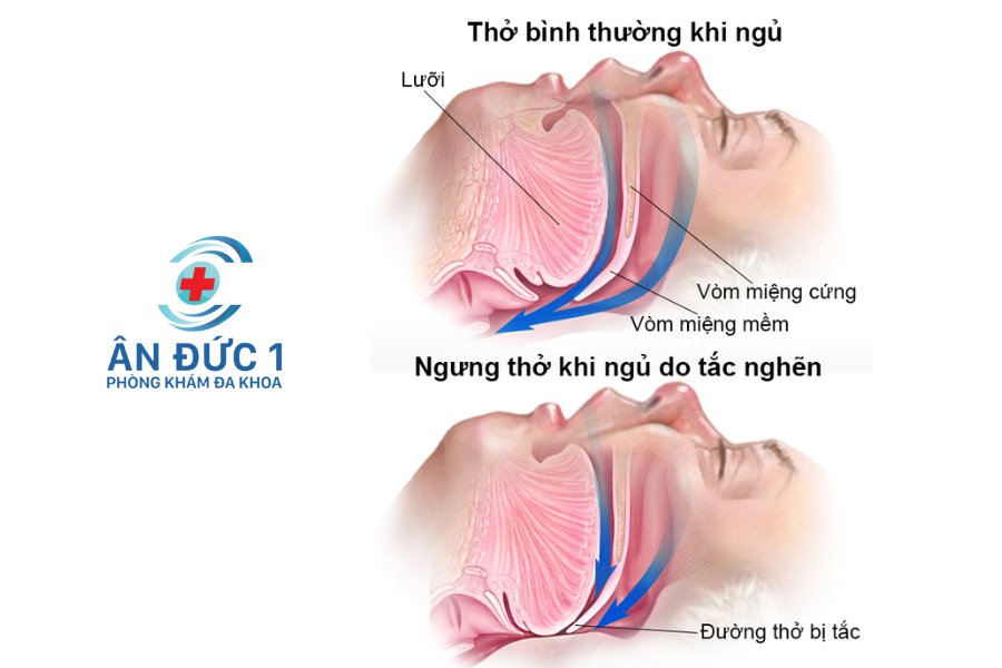 phòng tránh bệnh tai mũi họng