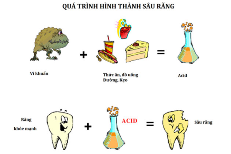 Bệnh răng miệng thường gặp
