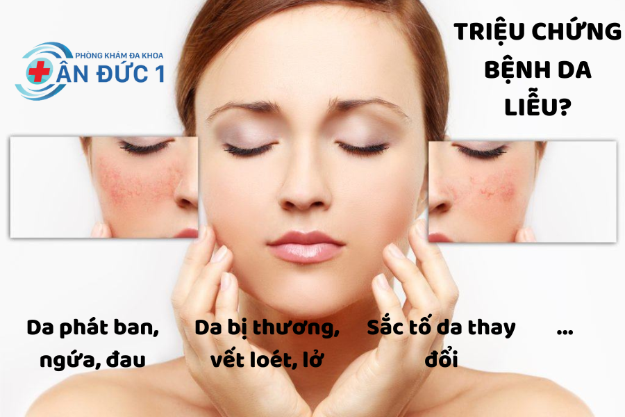 Triệu chứng và dấu hiệu của bệnh da liễu