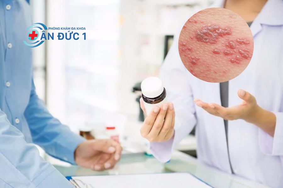 Uống thuốc kê đơn của bác sĩ