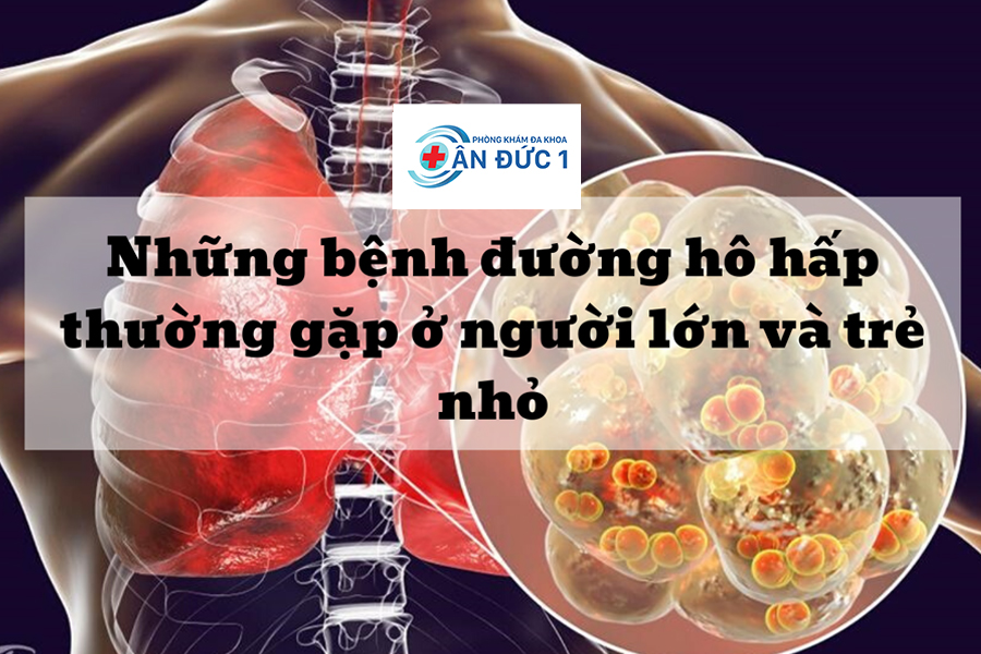 Các bệnh về đường hô hấp