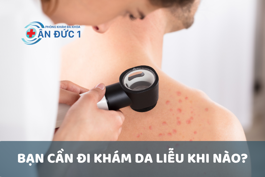 Bạn cần đi khám da liễu khi nào