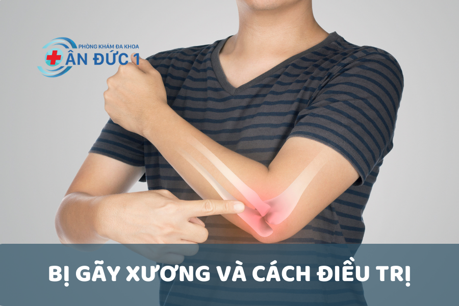 BỊ GÃY XƯƠNG VÀ CÁCH ĐIỀU TRỊ