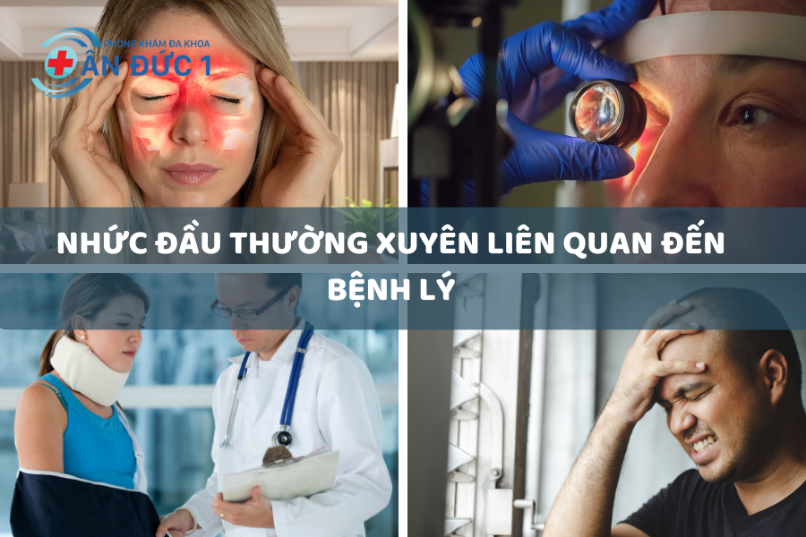 Đau đầu thường xuyên liên quan đến bệnh lý