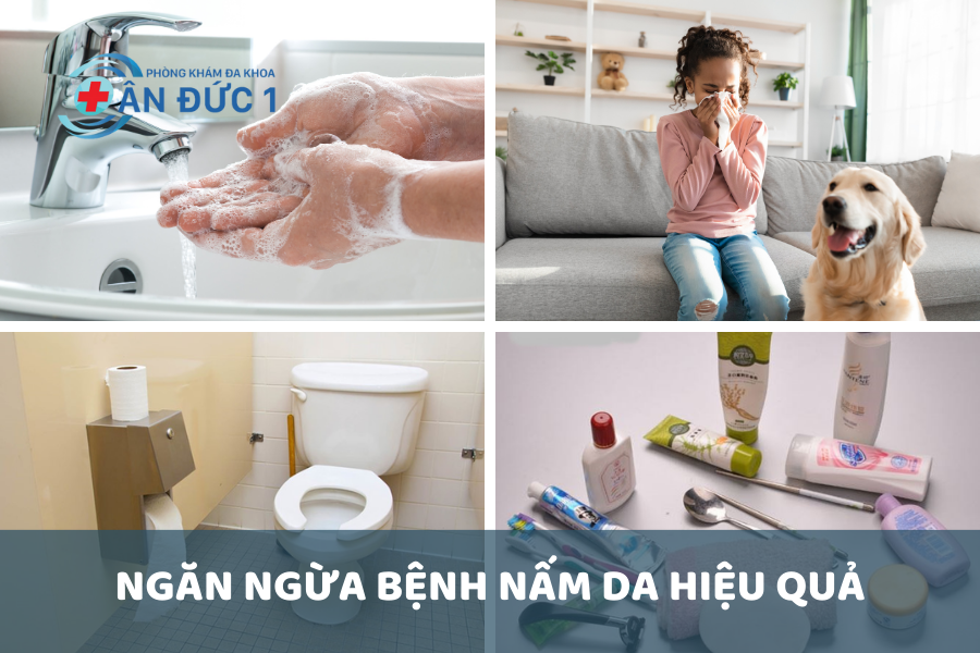 Ngăn ngừa bệnh nấm da hiệu quả