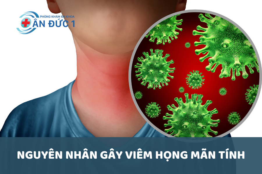 Nguyên nhân gây viêm họng mãn tính