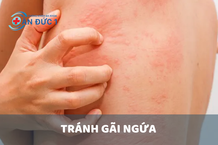 Tránh gãi ngứa