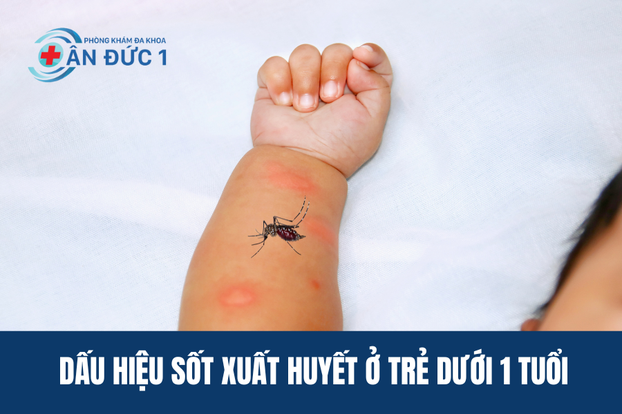 Dấu hiệu sốt xuất huyết ở trẻ dưới 1 tuổi